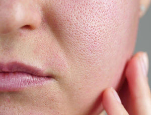 Best Products to Reduce Enlarged Pores
